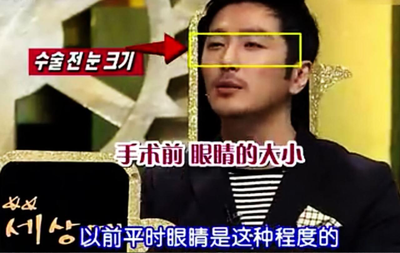 柳泰俊眯起眼睛，示意比划这是狗狗坦儿之前的眼睛大小